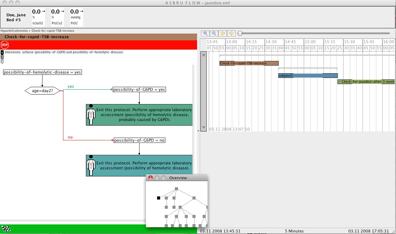 AsbruFlow application window showing a Jaundice plan.